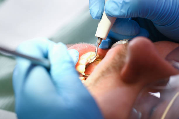 Best Weekend Emergency Dentist in Livingston, AL
